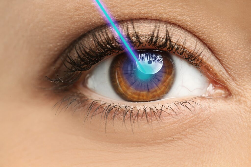 Potential Side Effects of LASIK Procedure: Prevention and Cure