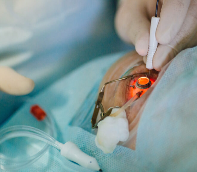 Am I a Good Candidate for LASIK Eye Surgery? Key Eligibility Factors